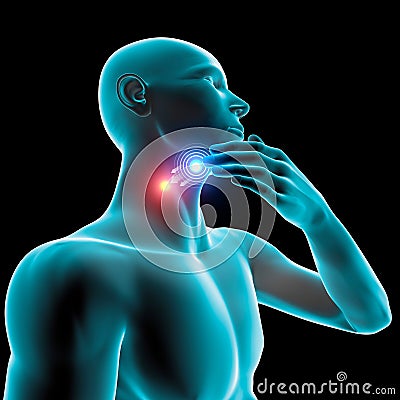 Sore throat inflammation, redness, pain burning, tablet and care Stock Photo