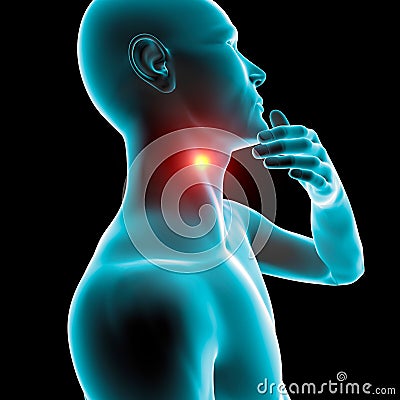 Sore throat inflammation, redness, pain, Stock Photo