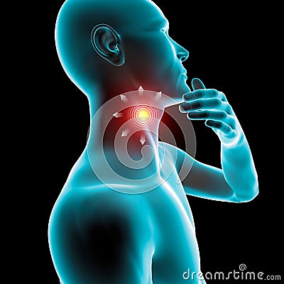 Sore throat inflammation, redness, pain, Stock Photo