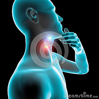 Sore throat inflammation, redness, pain, tablet and care Stock Photo