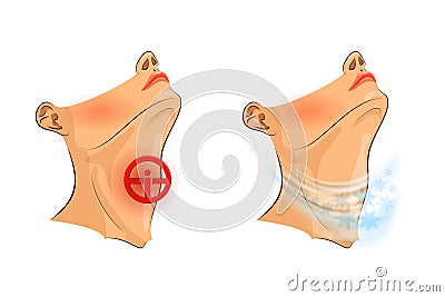 Sore throat. sore throat, pain relief Vector Illustration