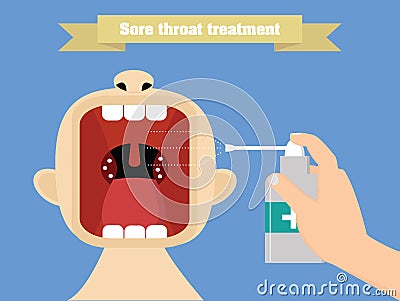 Sore throat treatment with aerosol. Quinsy treatment conceptual illustration Vector Illustration