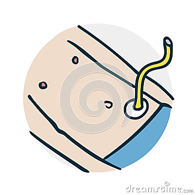 Special medical procedure on the intestine Vector Illustration