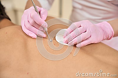 Specialist cosmetologist cleanses the skin of a clients back Stock Photo
