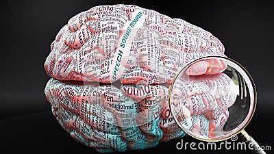 Speech sound disorder in human brain Stock Photo