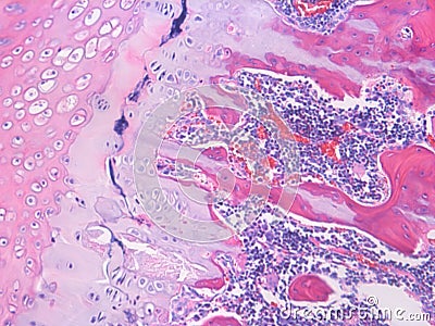 Histology of Spinal Column Bone Tissue Stock Photo