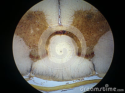 Spinal cord cross section Stock Photo