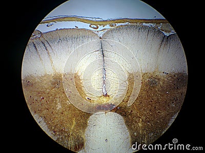 Spinal cord cross section Stock Photo