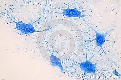 Spinal cord, Nerve, Cerebellum, Cortex and Motor Neuron Human under the microscope. Stock Photo