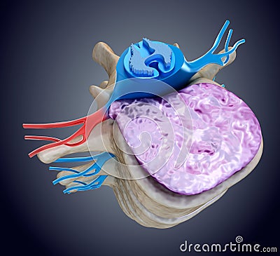 Spinal cord under pressure of bulging disc Stock Photo