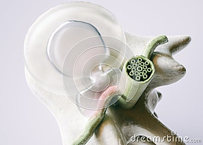 Spinal disc herniation as close-up as 3D Rendering Stock Photo