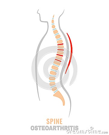 Spine osteoarthritis icon Vector Illustration