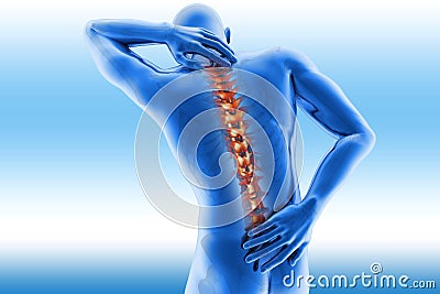 Spine pain - vertebrae trauma Stock Photo