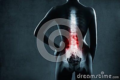 Spine in x-ray. Lumbar spine is highlighted. Stock Photo