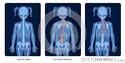 Spine X ray Vector Illustration