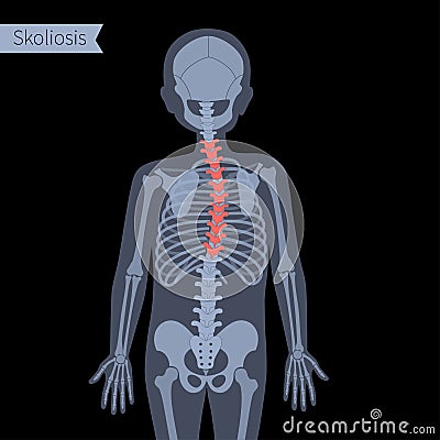 Spine X ray Vector Illustration