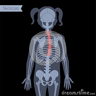 Spine X ray Vector Illustration