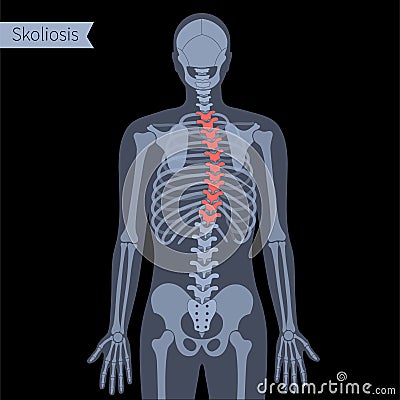 Spine X ray Vector Illustration