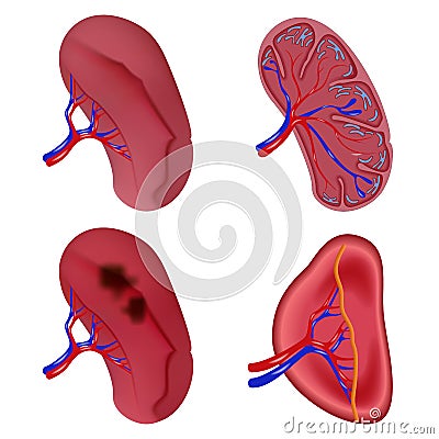 Spleen milt anatomy icons set, realistic style Vector Illustration