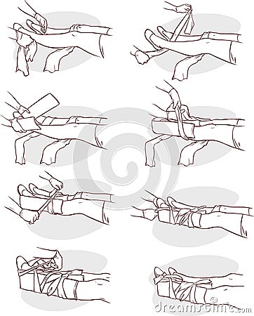 Splinting a Broken leg Vector Illustration