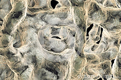 Spongy bone tissue affected by osteoporosis Cartoon Illustration