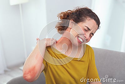 Young infected lady experiencing a spreading skin rash Stock Photo