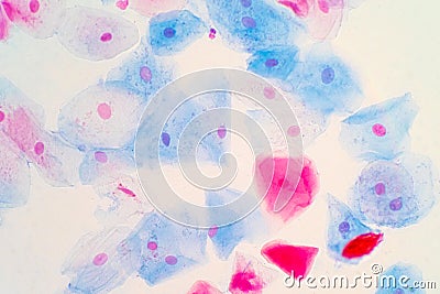 Squamous epithelial cells of human cervix under the microscope view Stock Photo