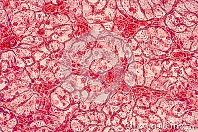 Squamous epithelial cells under microscope view for education hi Stock Photo