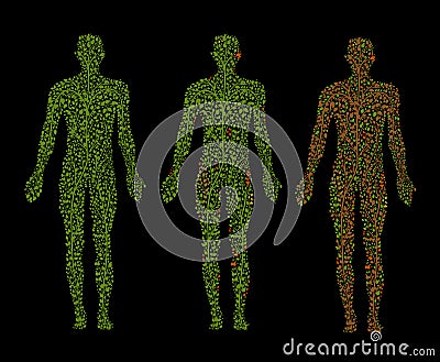 Stage of the decease concept, cancer concept, getting older, dying tissue idea, skin problem idea, Vector Illustration