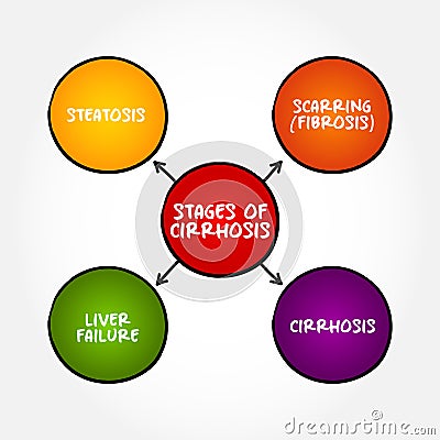Stages of cirrhosis - scarring of the liver caused by long-term liver damage Stock Photo