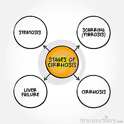 Stages of cirrhosis - scarring of the liver caused by long-term liver damage Stock Photo