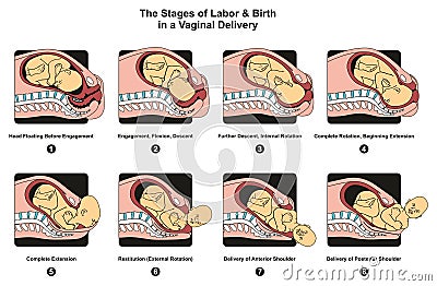 Stages of Labor and Birth in a vaginal delivery Vector Illustration