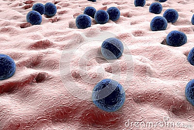 Staphylococci on the surface of skin Cartoon Illustration