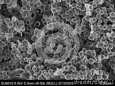 Staphylococcus aureus Scanning Electron Microscopy Stock Photo