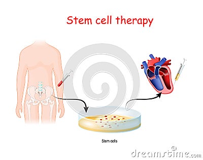 Stem cell therapy Vector Illustration