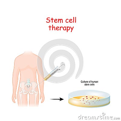 Stem cell therapy Vector Illustration
