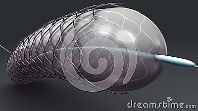 Stent Stock Photo