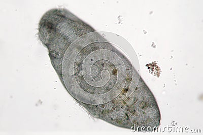 Stentor or trumpet animalcules is filter-feeding, heterotrophic protozoan ciliate moves in freshwater Stock Photo