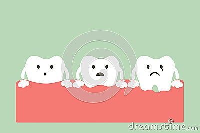 Step of gum disease Vector Illustration