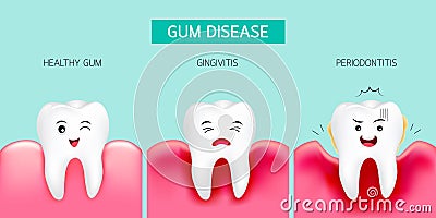 Step of gum disease. Healthy tooth and gingivitis. Vector Illustration