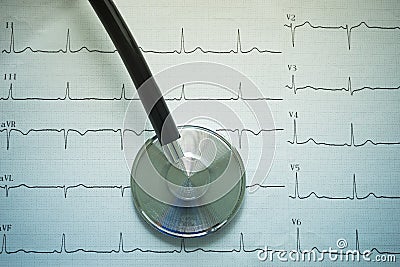Stethoscope and cardiograph. Stock Photo