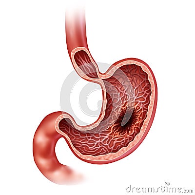 Stomach Cancer Concept Cartoon Illustration