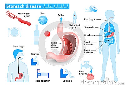 Stomach disease Vector Illustration