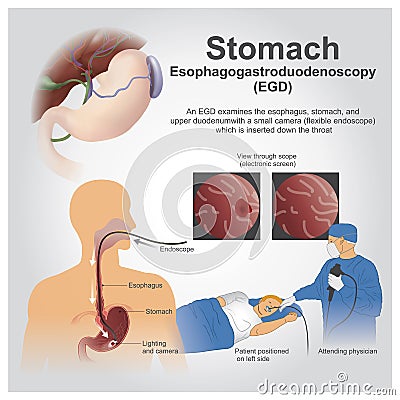 Stomach Vector Illustration