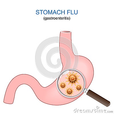 stomach flu. Human stomach, magnifying glass, and viruses Vector Illustration