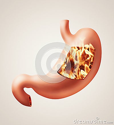 Stomach heartburn concept Cartoon Illustration