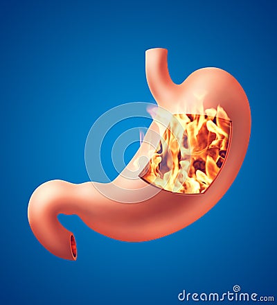 Stomach heartburn concept Cartoon Illustration