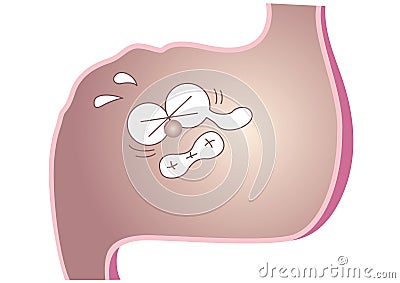 Stomach that hurts and distorts face Vector Illustration