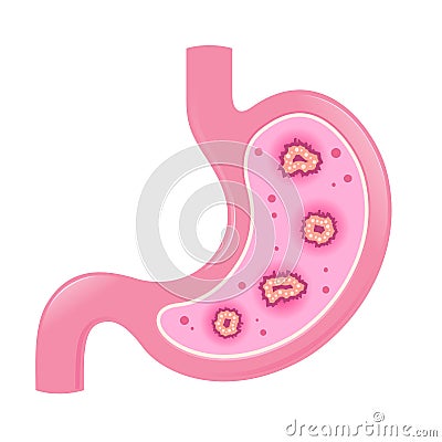 Stomach Intestine With Virus Or Bacteria Inside Vector Illustration