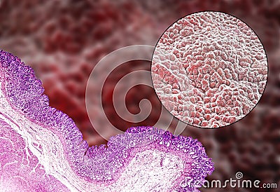 Stomach mucosa, micrograph and illustration Cartoon Illustration